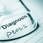 What Are the Top Causes of Ptosis?