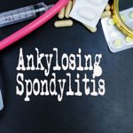 Treatments for Ankylosing Spondylitis