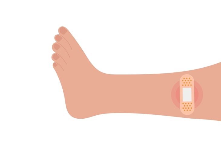 Leg with a bandage. Vector illustration