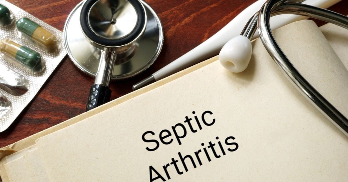 Frequently Asked Questions About Septic Arthritis Facty Health