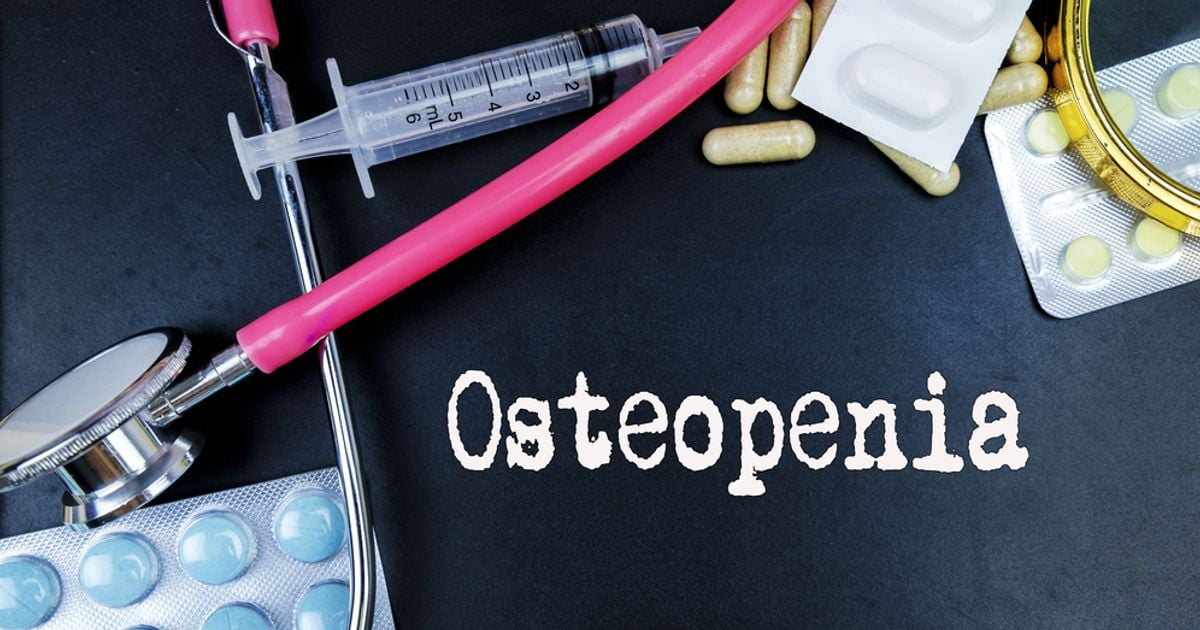 Comprehensive Guide to Understanding Osteopenia - Facty Health