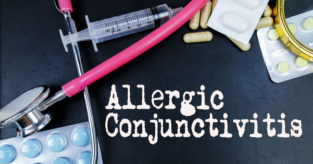 Allergic Conjunctivitis Causes, Symptoms, and Treatments Facty Health