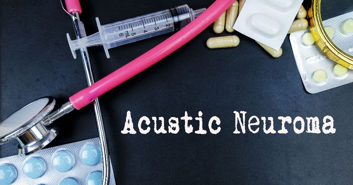 10 Frequently Asked Questions About Acoustic Neuroma Facty Health