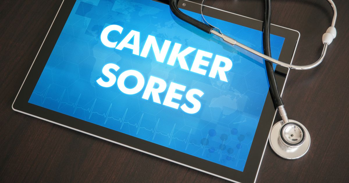 10 Causes of Canker Sores Facty Health