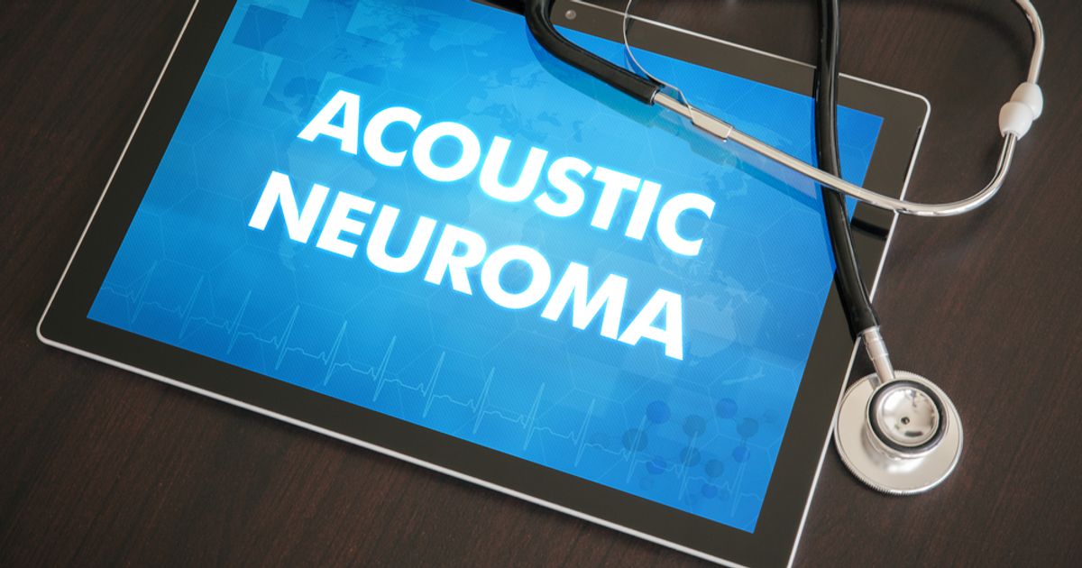 Symptoms, Causes and Treatment of Acoustic Neuroma Facty Health