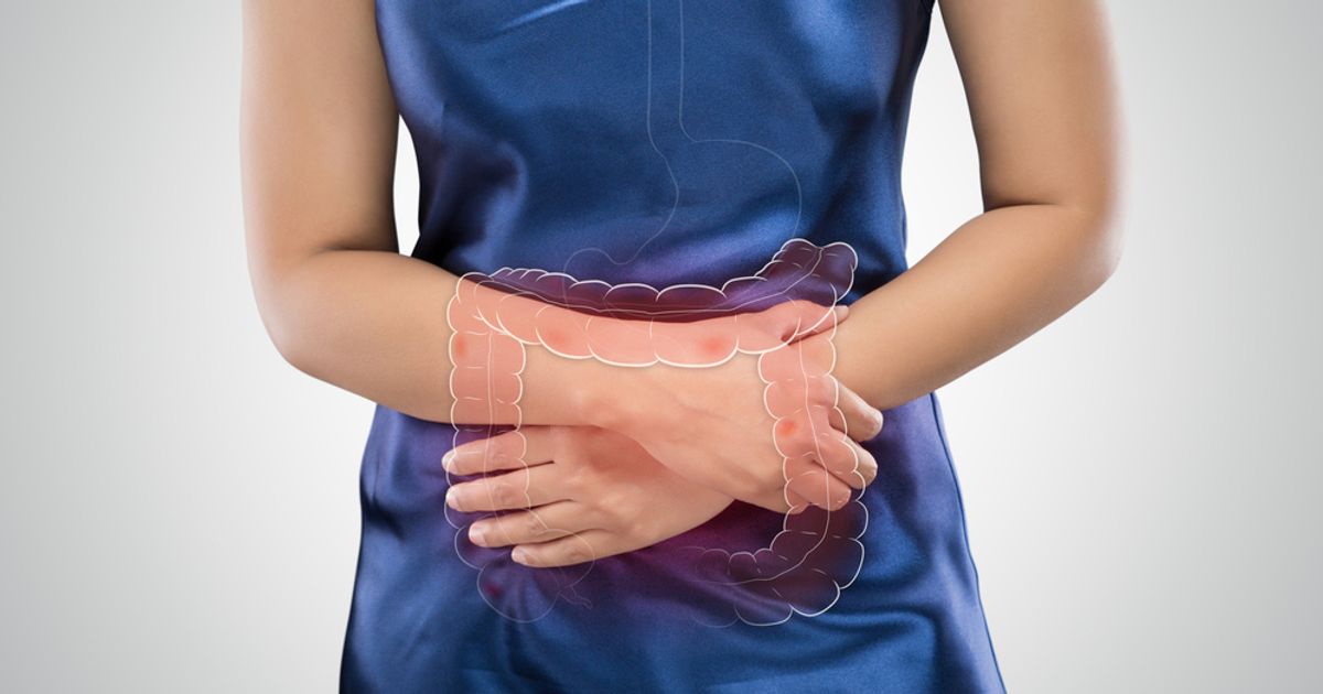 10 Symptoms of Intestinal Obstruction Facty Health