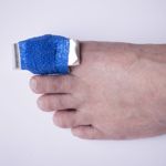FAQs about a Broken Toe