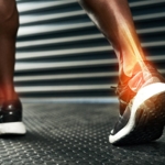 Important Facts About Hairline Fractures