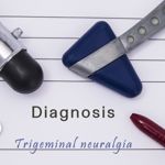 Decoding Trigeminal Neuralgia: From Symptoms to Psychological Impact