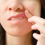 Can These 10 Methods Help Soothe Your Canker Sores?