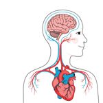 Preventing Vertebral Artery Occlusion: What You Need to Know