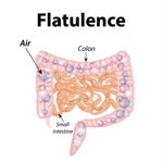 10 Gas-Inducing Foods to Skip on Low-Flatulence Diet