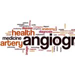 Navigating Your Angiogram: A Comprehensive Overview
