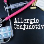Allergic Conjunctivitis: Causes, Symptoms, and Treatments