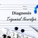 Treatments for Trigeminal Neuralgia