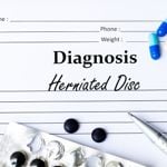 Understanding slipped discs: causes and treatment options.