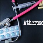 10 Symptoms of Atherosclerosis