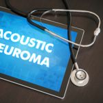 Is Acoustic Neuroma Common? A Comprehensive Guide