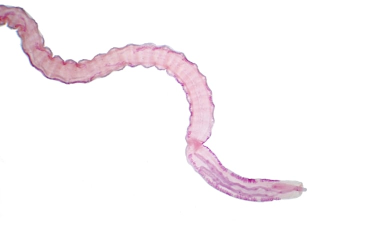Tapeworm (Parasitic flatworm) of cattle and other grazing animals under the microscope for education.