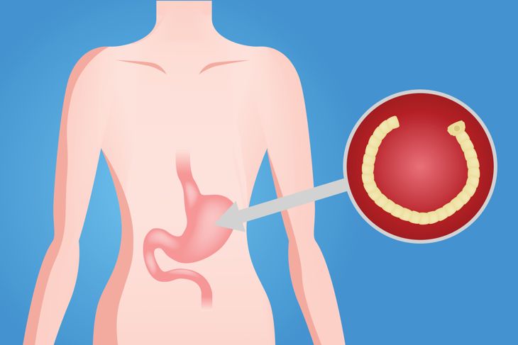 Everything You Need to Know About Tapeworm Infections