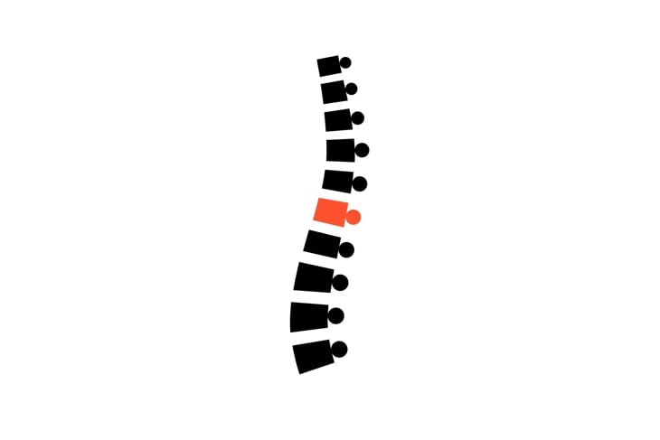 Pain in spine medical poster