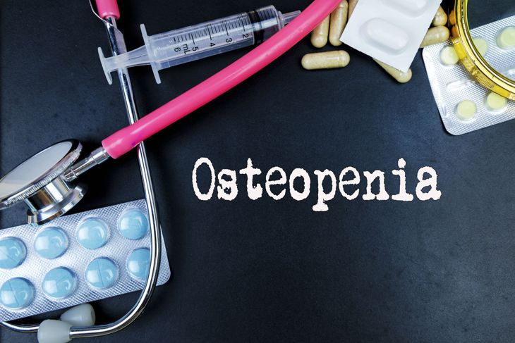 10 Treatments for Osteopenia