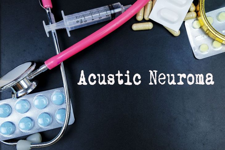 10 Frequently Asked Questions About Acoustic Neuroma