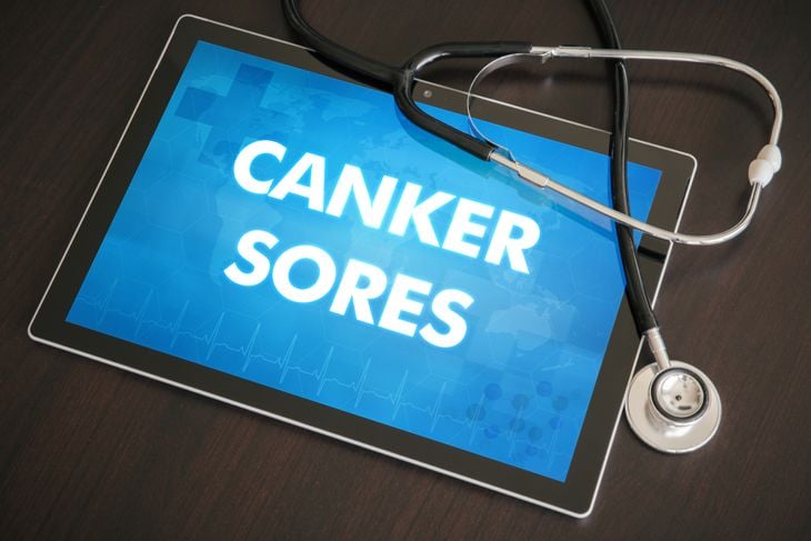 10 Causes of Canker Sores