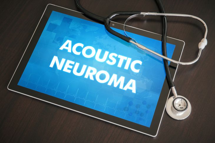 Is Acoustic Neuroma Common? A Comprehensive Guide