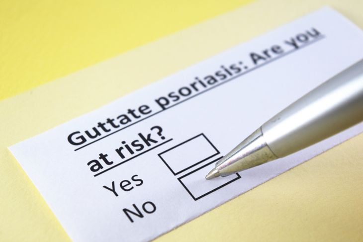 Symptoms and Treatments of Guttate Psoriasis
