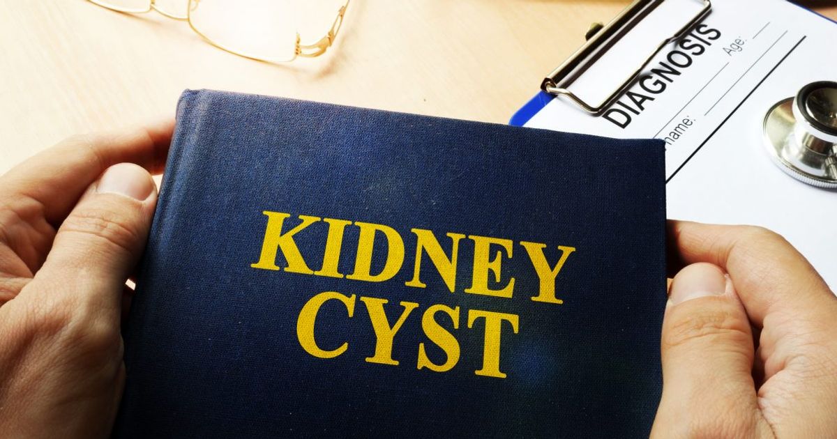 Treatments for Kidney Cysts Facty Health