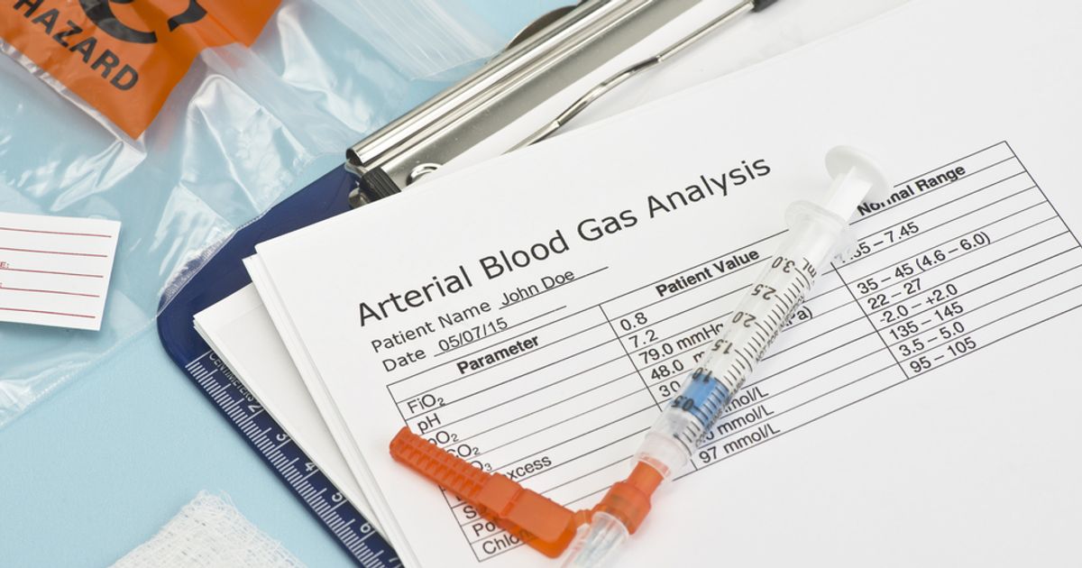 Frequently Asked Questions About Arterial Blood Gas Tests Facty Health