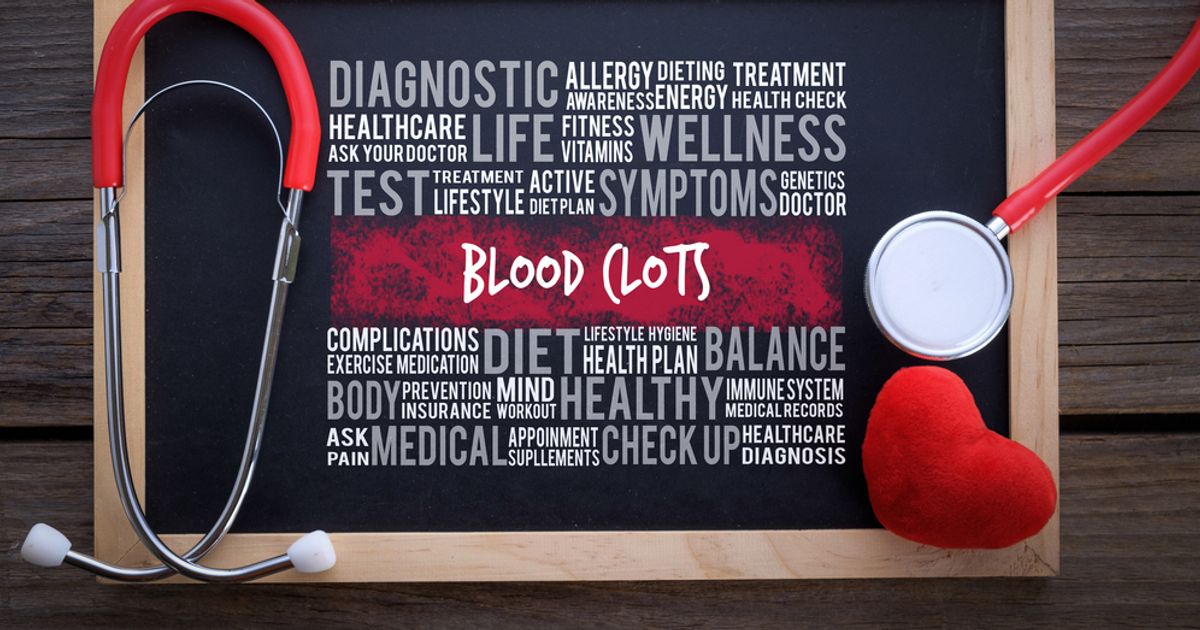 Causes of Blood Clots Facty Health