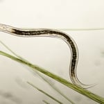 All About Worms in Poop