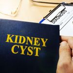 Understanding Kidney Cysts: Causes and Non-Invasive Treatment Options
