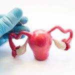 Frequently Asked Questions About Myomectomy Surgery