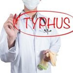 Causes, Symptoms, and Treatments of Typhus