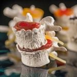 Natural Ways to Relieve Slipped Disc Pain