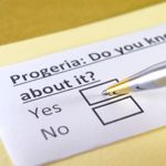 10 Facts About Progeria