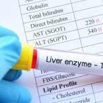Natural Ways to Reduce Liver Enzymes