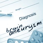 10 Frequently Asked Questions About Brain Aneurysms