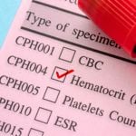 Understanding Hematocrit: Levels, Causes, and Treatments