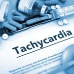 The Types of Tachycardia