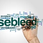 How to Limit Recurring Nosebleeds: A Step-by-Step Guide