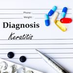 Frequently Asked Questions About Keratitis