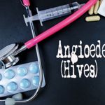 Treatments for Angioedema