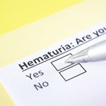 What is Microscopic Hematuria