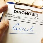 10 Worst Gout Trigger Foods and How to Get Relief