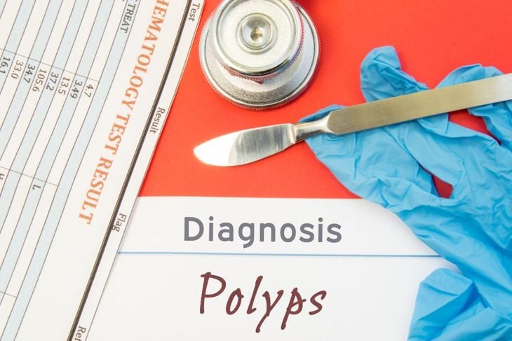 Decoding the Symptoms and Recovery Process of Colorectal Polyps