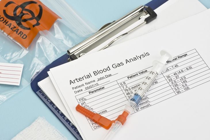 Frequently Asked Questions About Arterial Blood Gas Tests